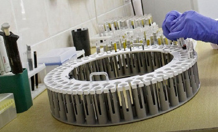 За сутки коронавирус выявили у 63 человек в Воронежской области